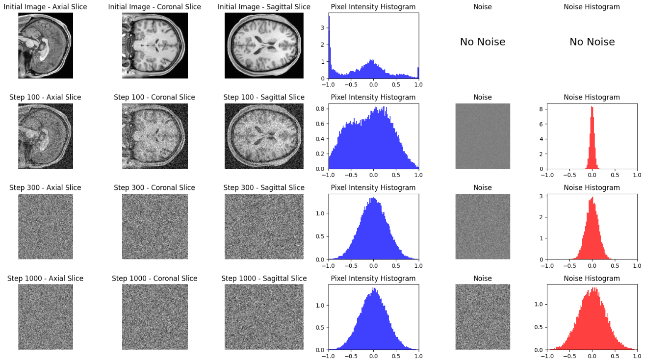 High Resolution MRI