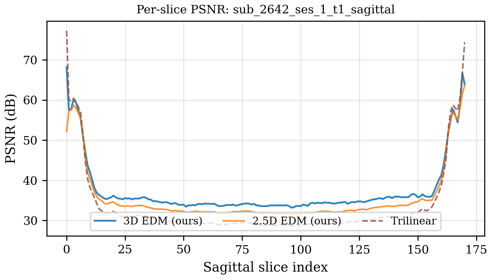 Per-slice PSNR curve